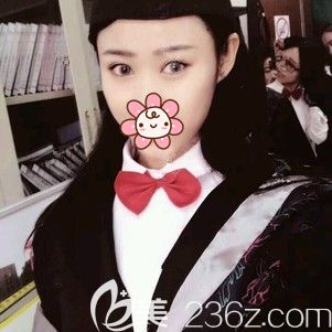 5张割双眼皮恢复日记图揭晓连云港榜上有名的眼部整形医师孙振东到底技术怎样