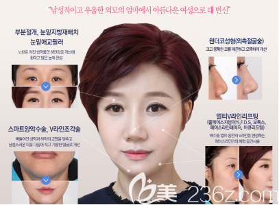 面部整形手术后的样子 面部整形手术后的样子