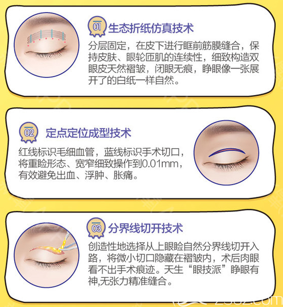 广东广州画美曾繁茂医生双眼皮手术技术