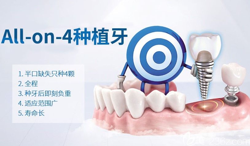 上海美奥口腔的all-on-4种植牙技术