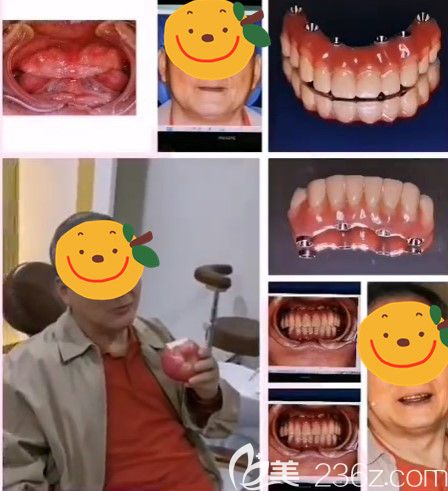 南京美奥口腔门诊部马建民术前照片1