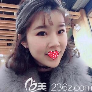 李春雷医生为我做鼻综合术后15天鼻子慢慢消肿中