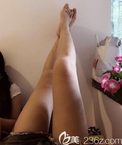 荆州吸脂哪家医院好?荆州华美大腿吸脂<span style= 荆州吸脂哪家医院好?荆州华美大腿吸脂<span style=