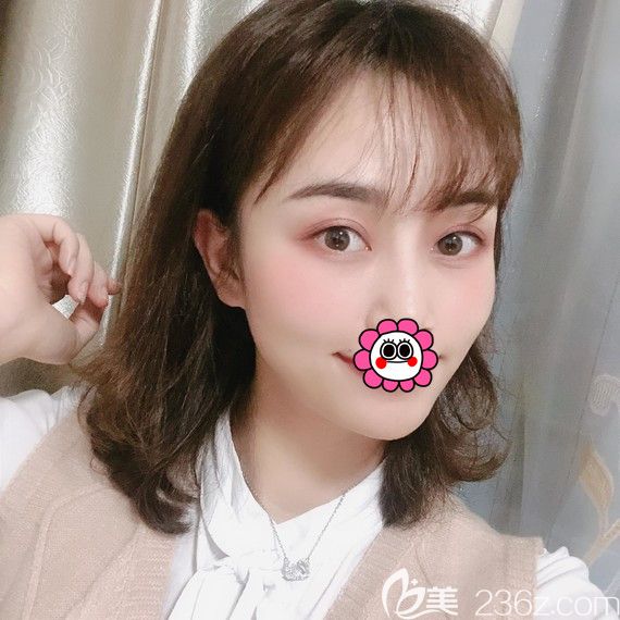 宁波薇琳自体脂肪面部填充<span style=