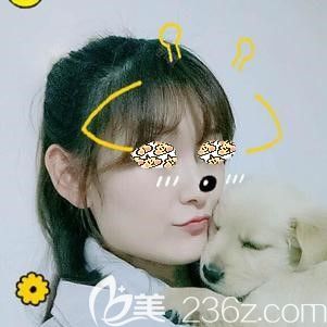 到合肥艺星做皮秒激光祛斑术后36天皮肤白净 到合肥艺星做皮秒激光祛斑术后36天皮肤白净