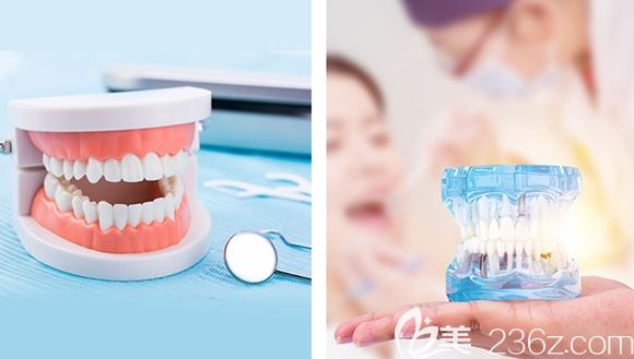 儿童窝沟封闭首颗免费 儿童窝沟封闭首颗免费