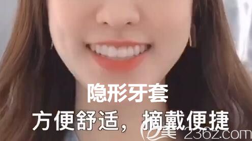 杭州齐尔口腔柯可医生介绍隐形矫正 杭州齐尔口腔柯可医生介绍隐形矫正