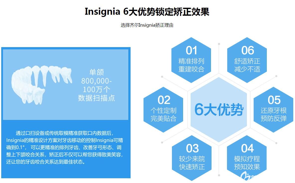 杭州齐尔口腔数字化正畸如何