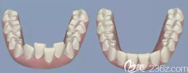 杭州齐尔口腔牙齿矫正怎么样