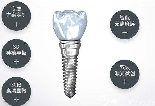 种植体结构示意图