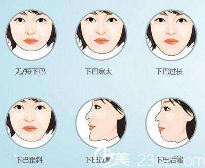 常见下巴症状