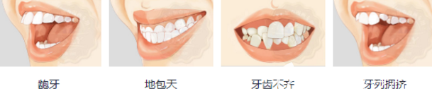 哪些牙齿需要做正畸