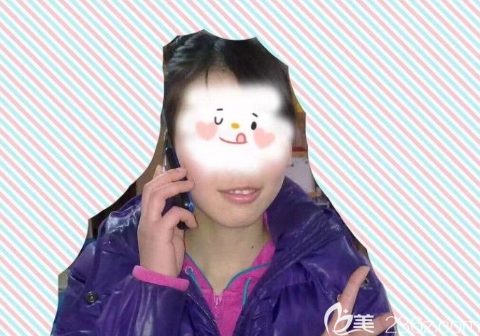 突嘴龅牙矫正前的照片 突嘴龅牙矫正前的照片