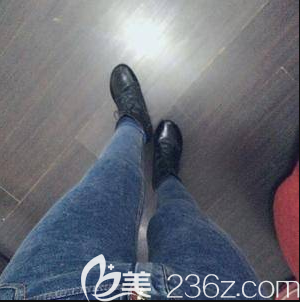 我在北京艺美做腿部吸脂第35天效果 我在北京艺美做腿部吸脂第35天效果