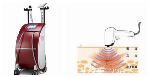 洛阳华美热拉提效果 洛阳华美热拉提效果