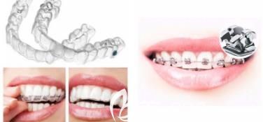 深圳徕可口腔牙齿矫正 深圳徕可口腔牙齿矫正