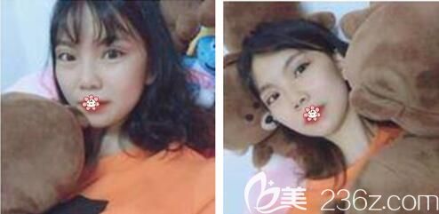 半个月那会儿 半个月那会儿