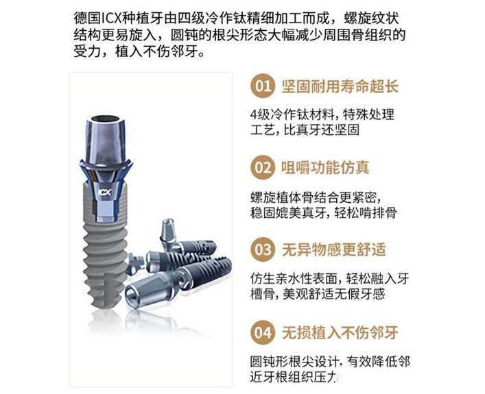 德国icx种植牙优势介绍