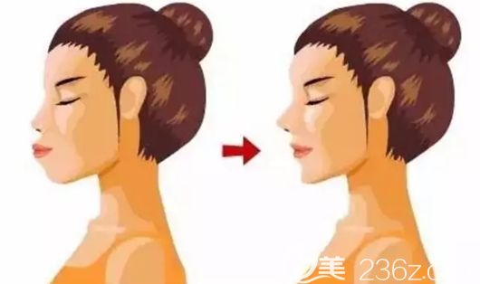 牙齿错颌畸形会影响面部发育 牙齿错颌畸形会影响面部发育