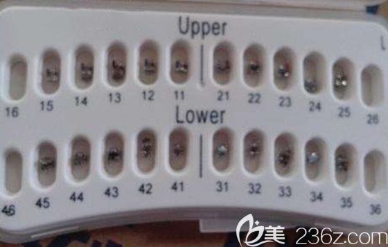 Damon自锁矫治器包装盒 Damon自锁矫治器包装盒