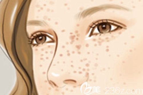 许昌博爱激光祛斑