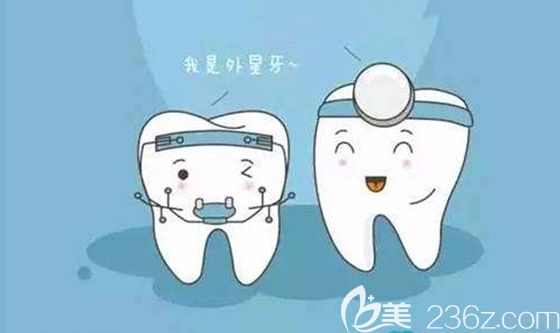 矫正器种类和价格不同正畸体验也不同 矫正器种类和价格不同正畸体验也不同