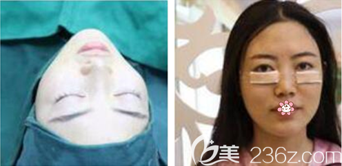 刘德东医生给我手术的当天 刘德东医生给我手术的当天