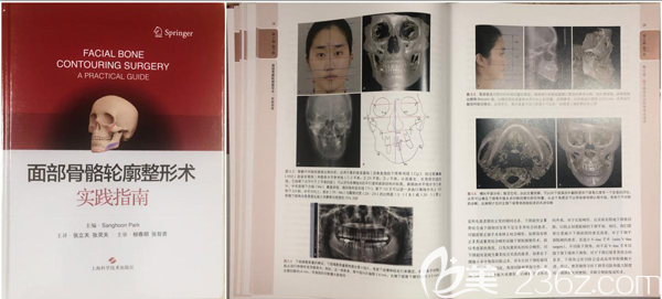 张立天主译的《面部骨骼轮廓整形术实践指南》