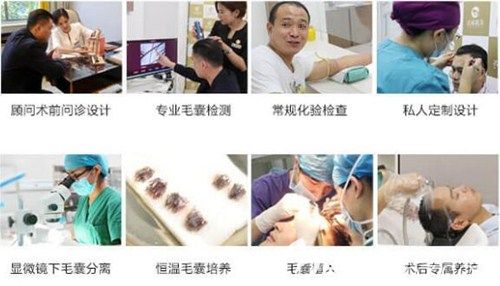 济南名韩植发手术流程 济南名韩植发手术流程