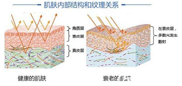 健康肌肤与衰老肌肤对比图