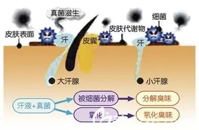 陈云娟分享腋臭产生原因