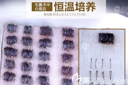 毛囊提取后要进行分离培育 毛囊提取后要进行分离培育