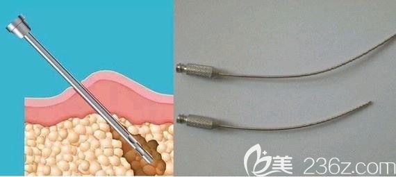 维纳斯吸脂的两根软针管
