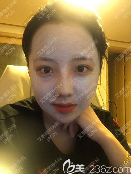 艾恩整形术后第11天 艾恩整形术后第11天