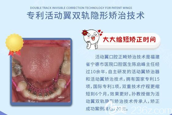 广州德系口腔舌侧隐形矫正优势