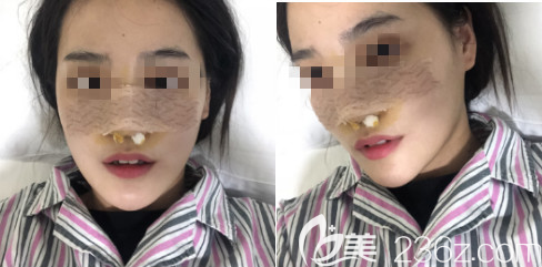 想起之前被大家<span style= 想起之前被大家<span style=