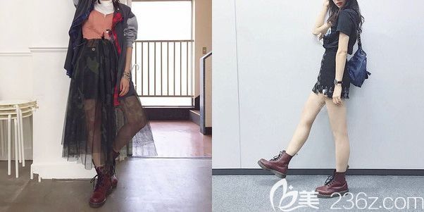 面诊南京韩辰前大腿较粗 面诊南京韩辰前大腿较粗