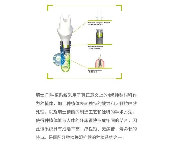 瑞士iti种植体优点介绍