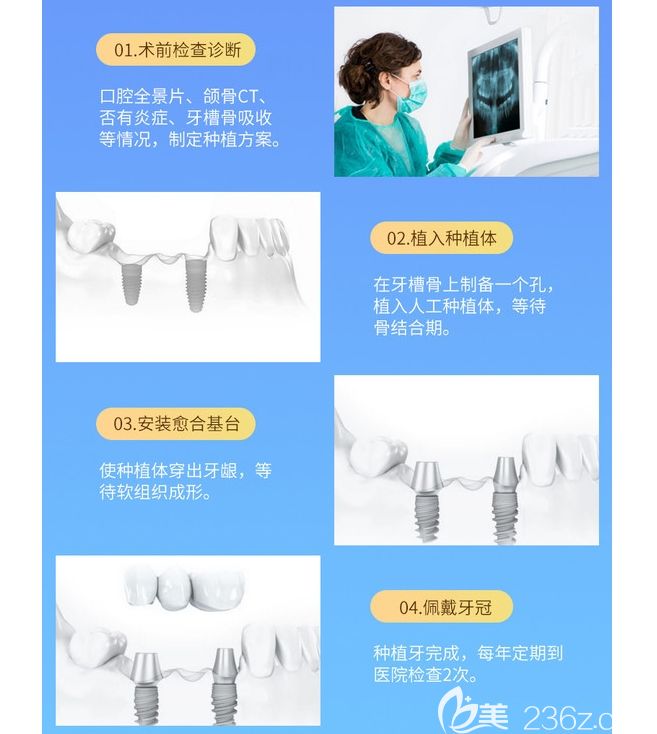 维乐口腔做种植牙步骤图示