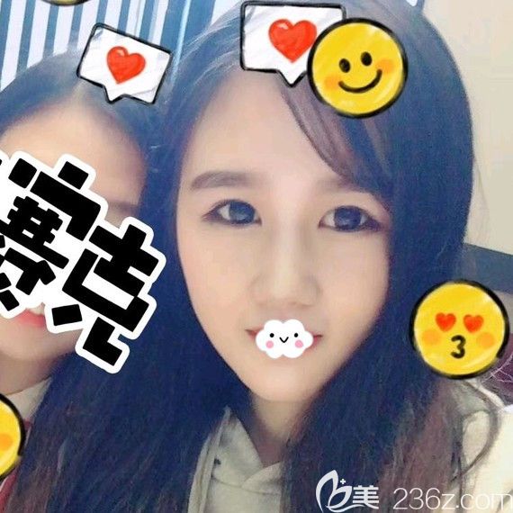 武汉垫下巴哪家医院好?卓美硅胶假体垫下巴案例 武汉垫下巴哪家医院好?卓美硅胶假体垫下巴案例