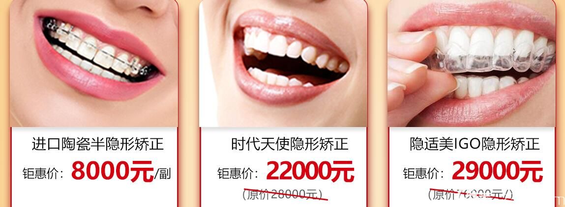 广州广大牙齿矫正价格公示
