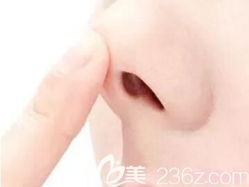 假体隆鼻后出现包膜挛缩怎么办？