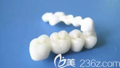 全瓷牙 全瓷牙