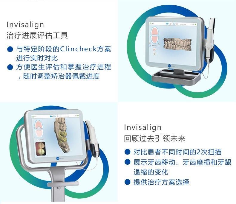 iTero隐适美口扫优势 iTero隐适美口扫优势