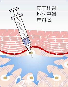 杨主任微整形推崇扇形注射法