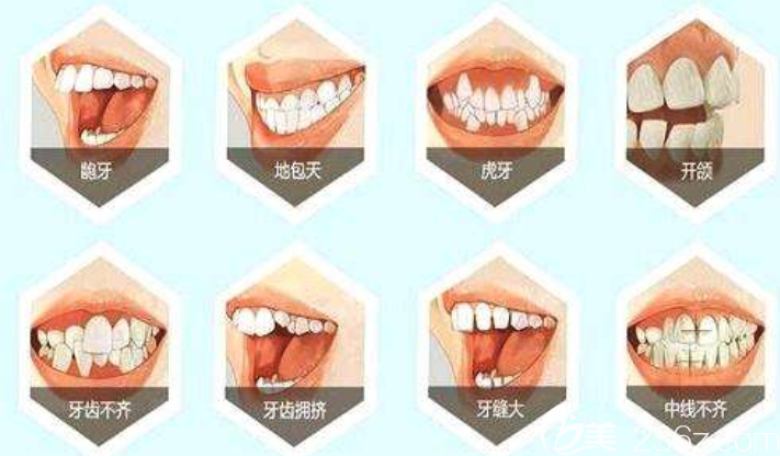 哪些人需要做牙齿矫正