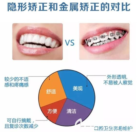 隐形矫正和金属矫正对比图告诉你哪种好