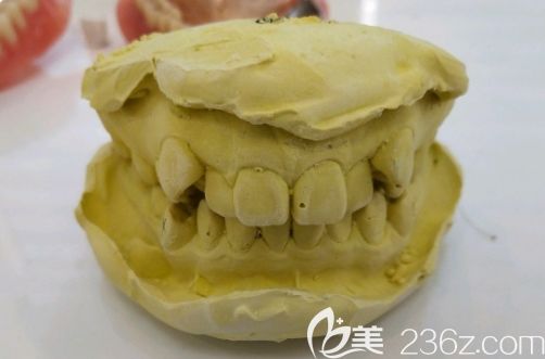 在长沙美奥口腔拍牙片 在长沙美奥口腔拍牙片