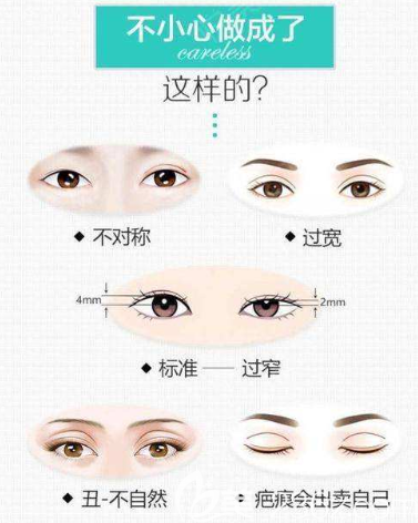 哪些眼睛需要做双眼皮修复 哪些眼睛需要做双眼皮修复