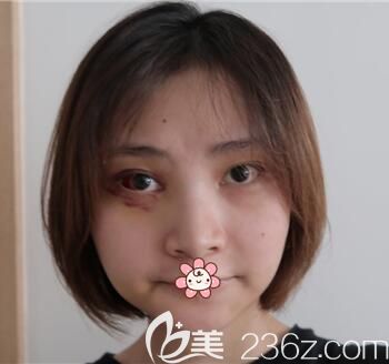 20天后 20天后